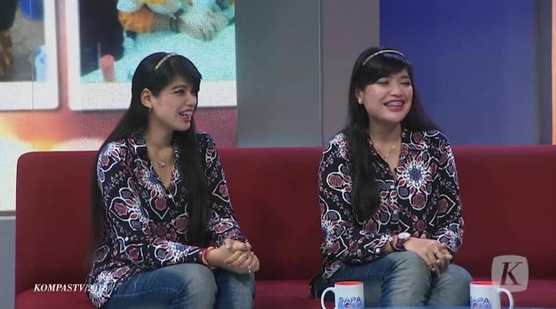 32 Tahun Operasi Kembar Siam Dempet Kepala yang Fenomenal