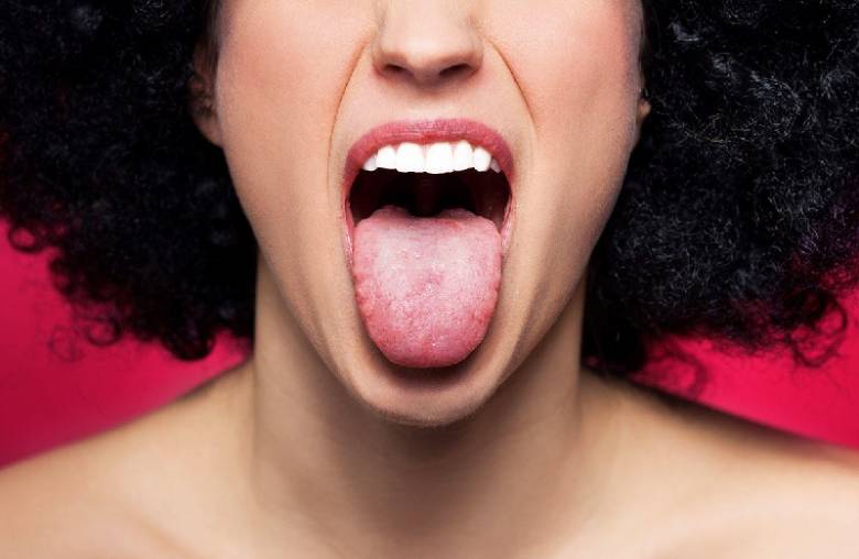 Kanker Lidah Dapat Terjadi Karena Hasil Mutasi Gen