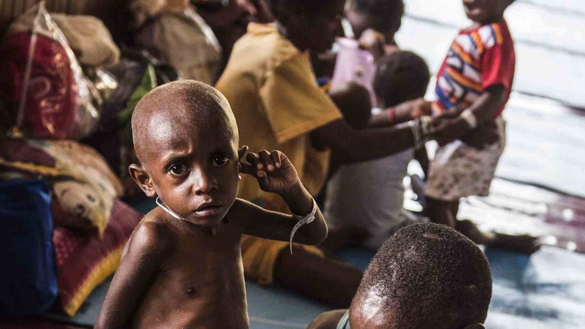 Meski KLB Dicabut, Penderitaan Suku Asmat di Papua Masih Berlanjut