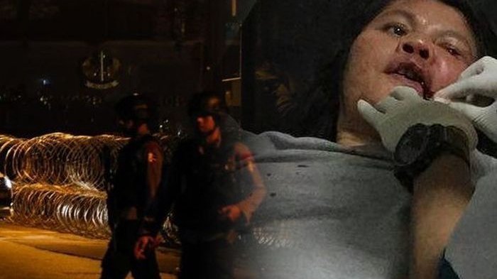 Tak Perlu Bicara Politik, Bersimpati Saja pada Urat Leher Korban