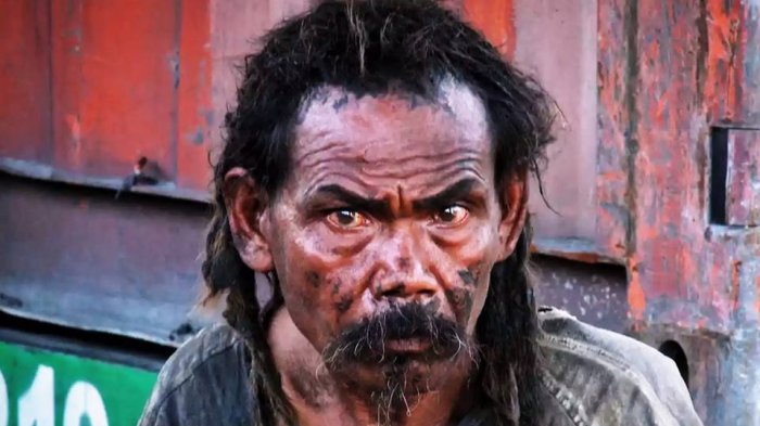 Benarkah Orang Gila Kebal Penyakit?