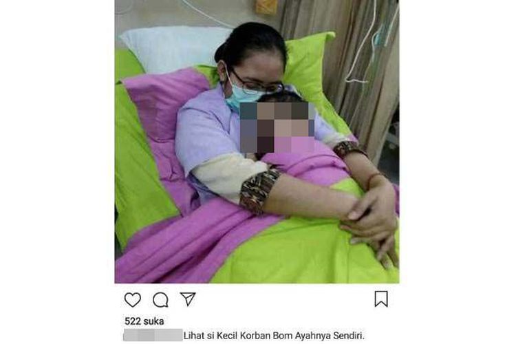 Balita dengan Wajah Gosong, Korban Keyakinan Orangtua yang Ngaco